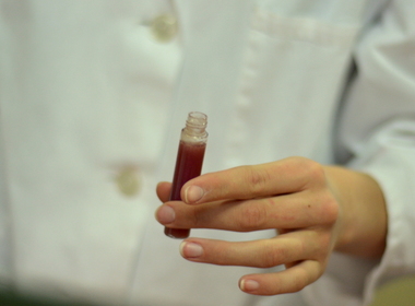 Simbolična fotografija za članek z naslovom: Kemijski lipgloss